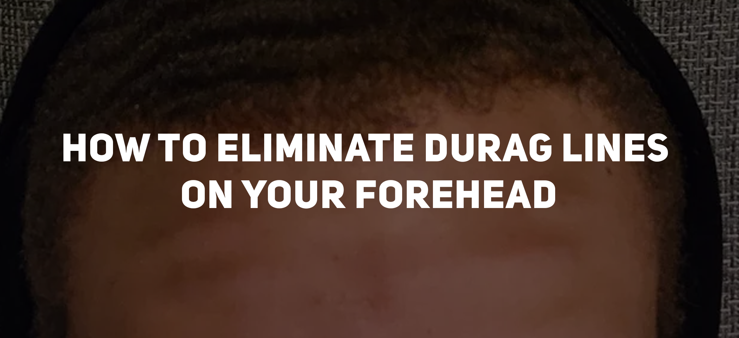 How to Eliminate Durag Lines on Your Forehead